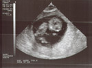 [our son was due 02.15.04]